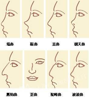十种鼻型