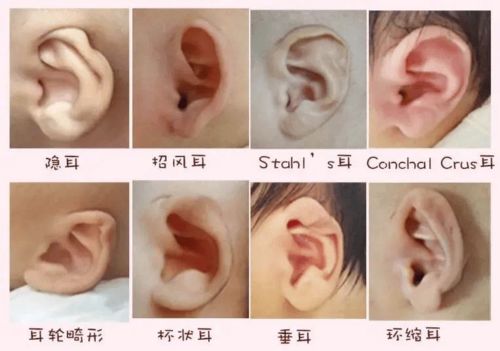 各种耳朵形状
